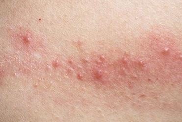 ���|��Ƥ�װY��