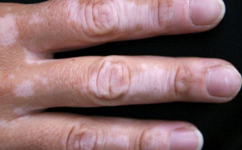 ����L(f��ng)�Y��