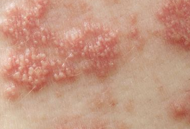 �����Y��