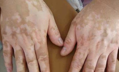 �L���������ί�����L