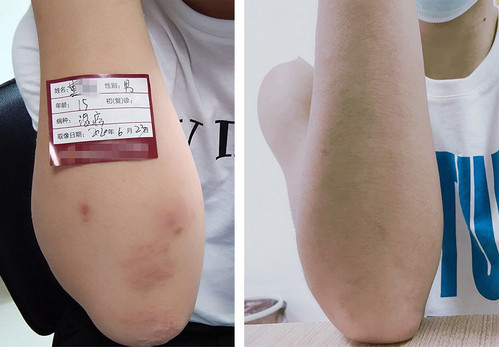 �L���ļ��t(y��)Ժ�������