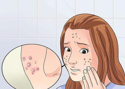 ë���׺��ഺ����ʲô�^�e