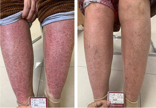 �L���w�����ί��tƤ��ţƤ�_��