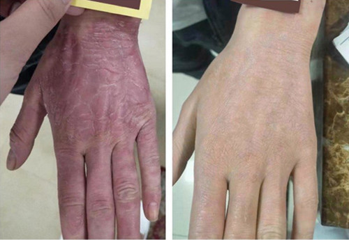 �L���w�����ί��tƤ��ţƤ�_��