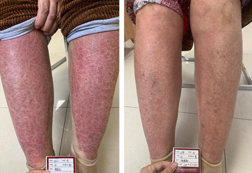 �L���ί��tƤ��ţƤ�_�����X