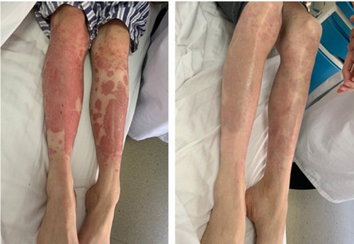 �L���ί��tƤ��ţƤ�_�����X