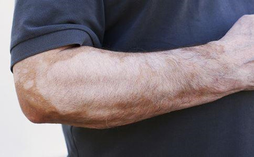 Ƥ�w��������T�l(f��)����L(f��ng)?�����@���c���A(y��)����(chu��ng)���԰���L(f��ng)!