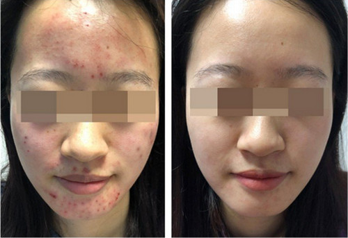 �L�����￴�^����Ƥ�ױ��^��