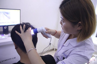 長春脫發要做哪些檢查