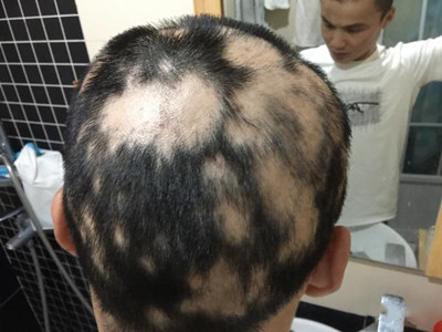 �߶d��ʲôԭ����ɵ�