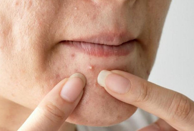 �°��L����ʲôԭ��