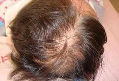 ��(j��ng)��Ó�l(f��)��ʲôԭ�������