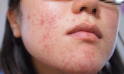 ��Ҋ���沿Ƥ�׷N�����Щ?