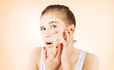 面部痤瘡是什么原因引起的