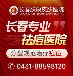 長春痘印治療醫院發表黑色痘印怎么辦